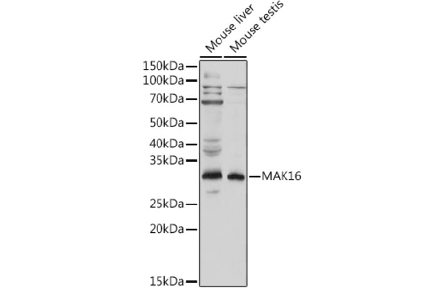 Western Blot - Anti-MAK16 Antibody (A308501) - Antibodies.com