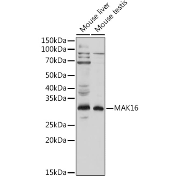 Western Blot - Anti-MAK16 Antibody (A308501) - Antibodies.com