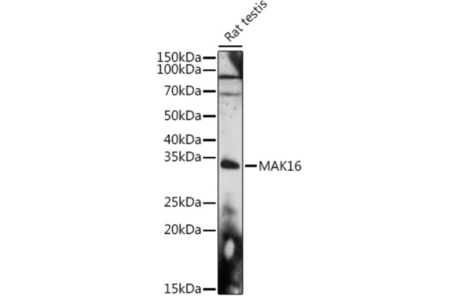 Western Blot - Anti-MAK16 Antibody (A308501) - Antibodies.com