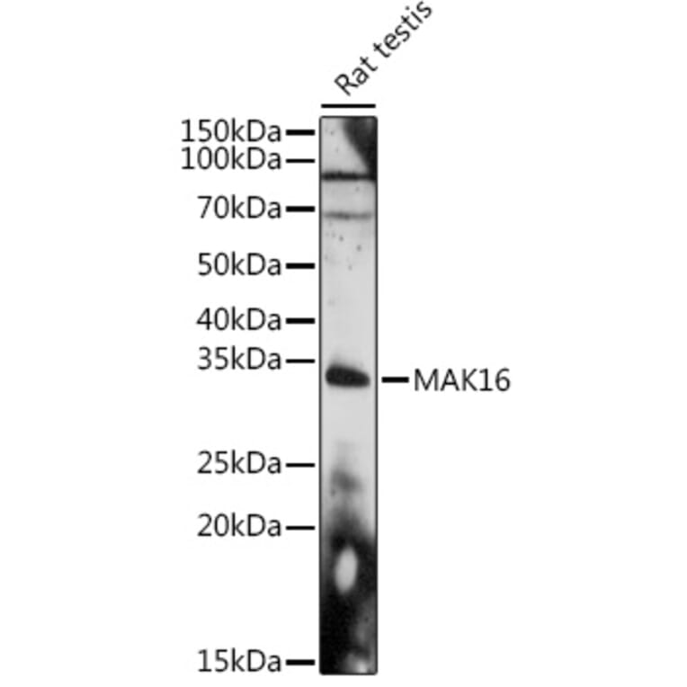 Western Blot - Anti-MAK16 Antibody (A308501) - Antibodies.com