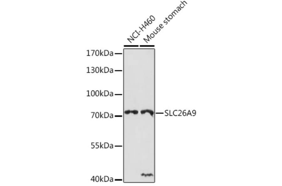 Western Blot - Anti-SLC26A9 Antibody (A308502) - Antibodies.com