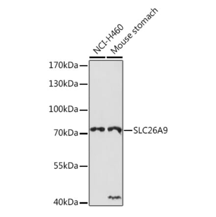 Western Blot - Anti-SLC26A9 Antibody (A308502) - Antibodies.com