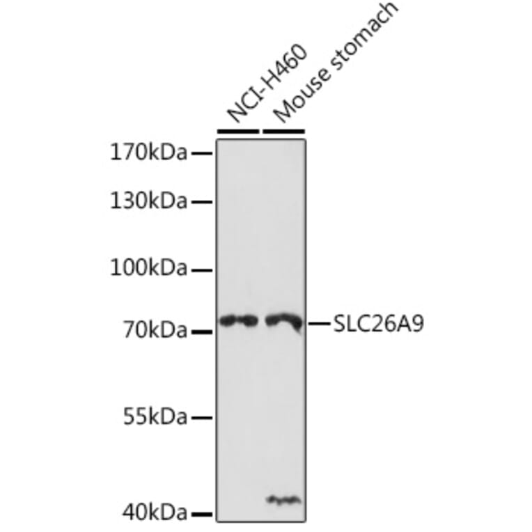 Western Blot - Anti-SLC26A9 Antibody (A308502) - Antibodies.com