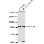 Western Blot - Anti-SLC26A9 Antibody (A308502) - Antibodies.com