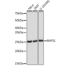 Western Blot - Anti-BAP31 Antibody [ARC1894] (A308503) - Antibodies.com