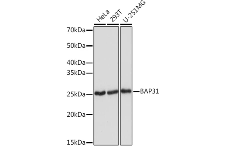 Western Blot - Anti-BAP31 Antibody [ARC1894] (A308503) - Antibodies.com