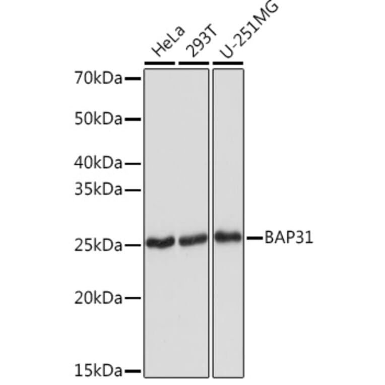 Western Blot - Anti-BAP31 Antibody [ARC1894] (A308503) - Antibodies.com