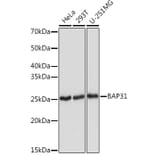Western Blot - Anti-BAP31 Antibody [ARC1894] (A308503) - Antibodies.com