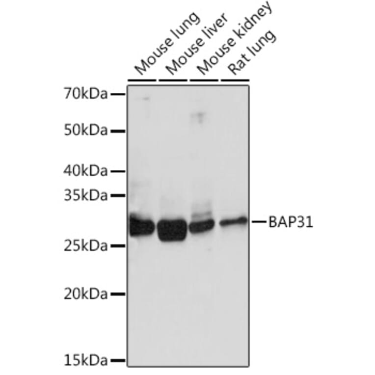 Western Blot - Anti-BAP31 Antibody [ARC1894] (A308503) - Antibodies.com