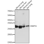 Western Blot - Anti-BAP31 Antibody [ARC1894] (A308503) - Antibodies.com