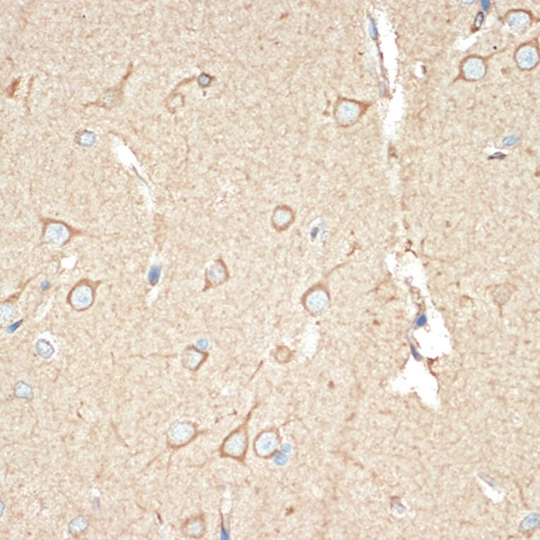 Immunohistochemistry - Anti-BAP31 Antibody [ARC1894] (A308503) - Antibodies.com