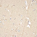 Immunohistochemistry - Anti-BAP31 Antibody [ARC1894] (A308503) - Antibodies.com