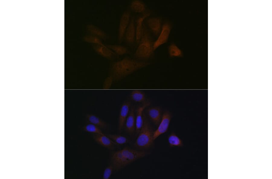 Immunofluorescence - Anti-BAP31 Antibody [ARC1894] (A308503) - Antibodies.com