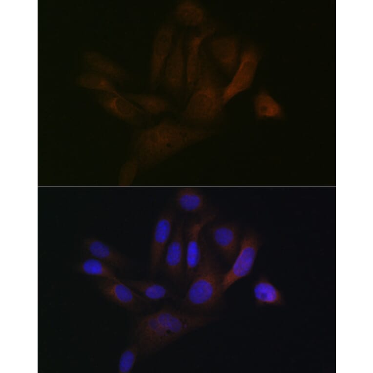 Immunofluorescence - Anti-BAP31 Antibody [ARC1894] (A308503) - Antibodies.com