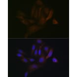 Immunofluorescence - Anti-BAP31 Antibody [ARC1894] (A308503) - Antibodies.com
