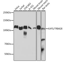 Western Blot - Anti-KAP1 Antibody [ARC0047] (A308504) - Antibodies.com