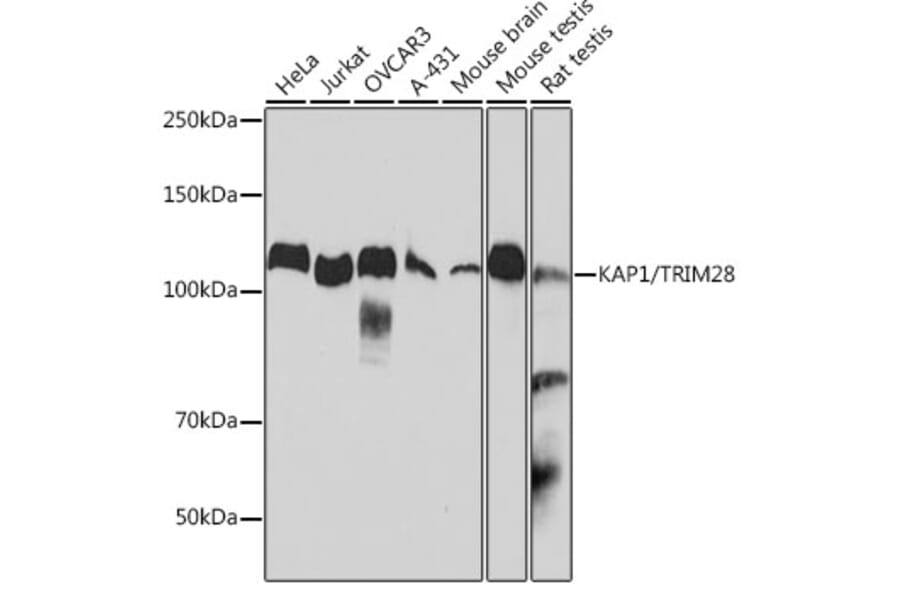 Western Blot - Anti-KAP1 Antibody [ARC0047] (A308504) - Antibodies.com