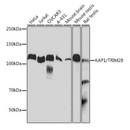 Western Blot - Anti-KAP1 Antibody [ARC0047] (A308504) - Antibodies.com