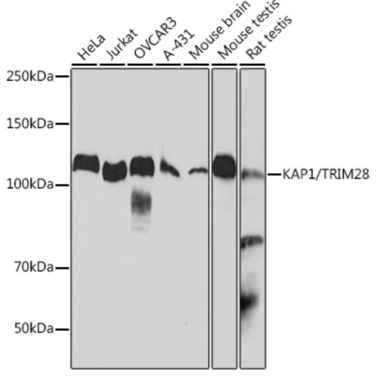 Western Blot - Anti-KAP1 Antibody [ARC0047] (A308504) - Antibodies.com