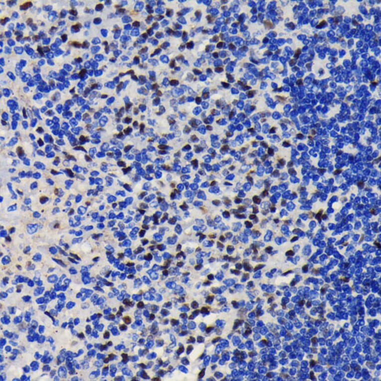 Immunohistochemistry - Anti-KAP1 Antibody [ARC0047] (A308504) - Antibodies.com