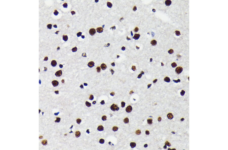 Immunohistochemistry - Anti-KAP1 Antibody [ARC0047] (A308504) - Antibodies.com