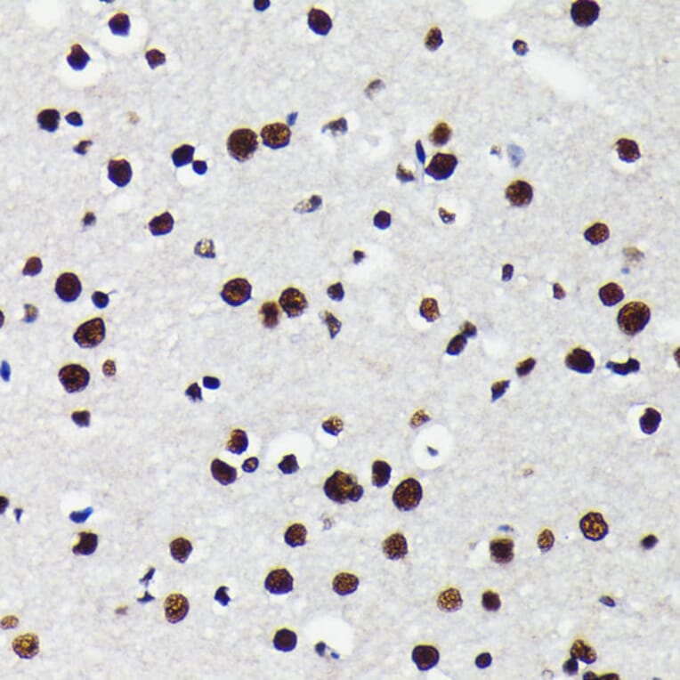 Immunohistochemistry - Anti-KAP1 Antibody [ARC0047] (A308504) - Antibodies.com