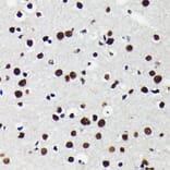 Immunohistochemistry - Anti-KAP1 Antibody [ARC0047] (A308504) - Antibodies.com