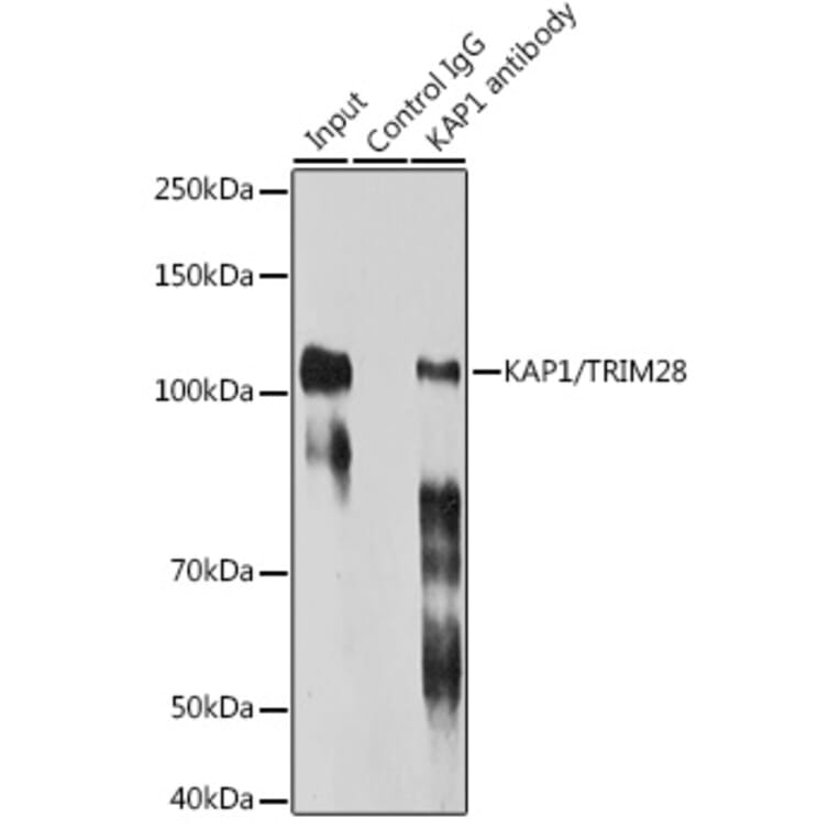 Western Blot - Anti-KAP1 Antibody [ARC0047] (A308504) - Antibodies.com