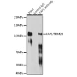 Western Blot - Anti-KAP1 Antibody [ARC0047] (A308504) - Antibodies.com