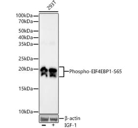 Western Blot - Anti-eIF4EBP1 (phospho Ser65) Antibody (A308505) - Antibodies.com