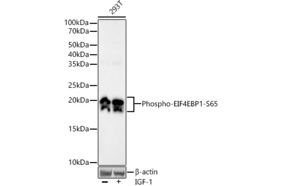 Western Blot - Anti-eIF4EBP1 (phospho Ser65) Antibody [ARC53775] (A308505) - Antibodies.com