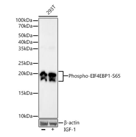Western Blot - Anti-eIF4EBP1 (phospho Ser65) Antibody [ARC53775] (A308505) - Antibodies.com