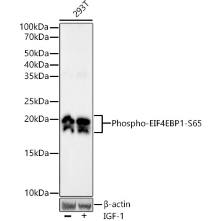 Western Blot - Anti-eIF4EBP1 (phospho Ser65) Antibody [ARC53775] (A308505) - Antibodies.com