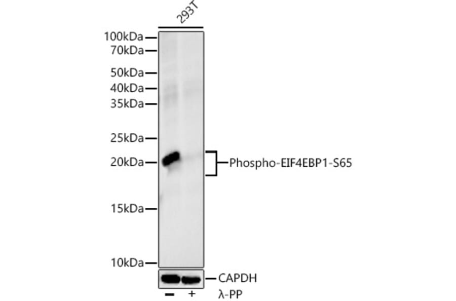 Western Blot - Anti-eIF4EBP1 (phospho Ser65) Antibody [ARC53775] (A308505) - Antibodies.com