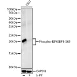 Western Blot - Anti-eIF4EBP1 (phospho Ser65) Antibody [ARC53775] (A308505) - Antibodies.com