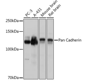 Western Blot - Anti-pan Cadherin Antibody (A308508) - Antibodies.com