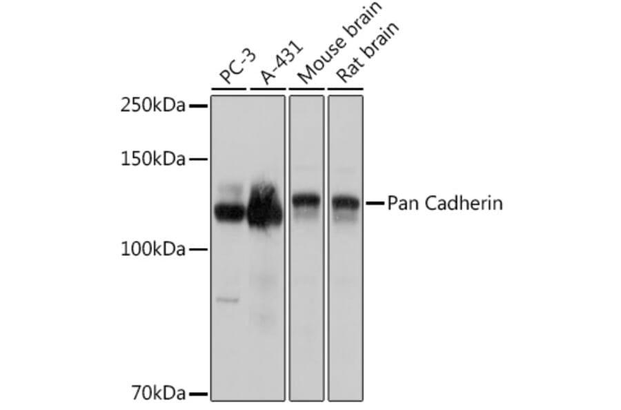 Western Blot - Anti-pan Cadherin Antibody (A308508) - Antibodies.com