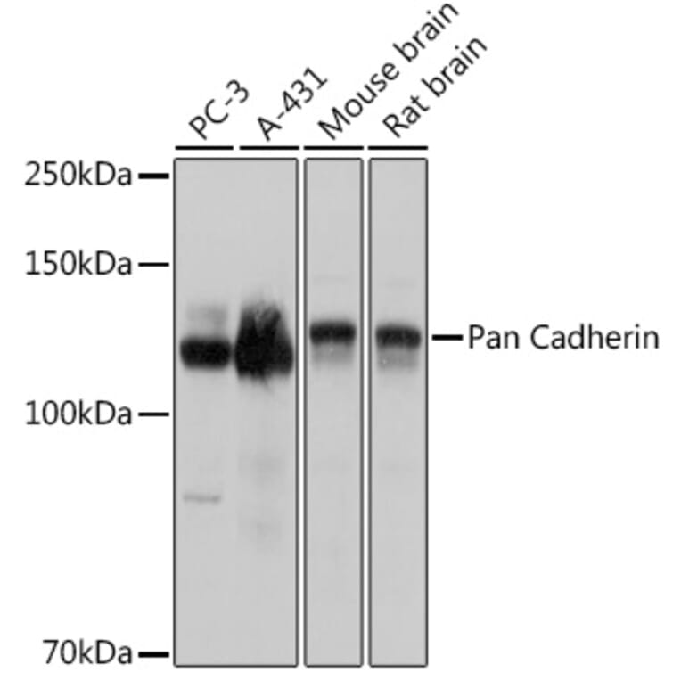 Western Blot - Anti-pan Cadherin Antibody (A308508) - Antibodies.com