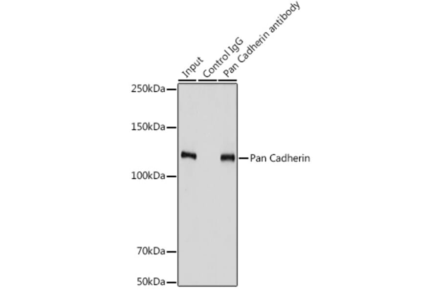 Western Blot - Anti-pan Cadherin Antibody (A308508) - Antibodies.com