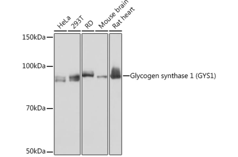 Western Blot - Anti-Glycogen synthase 1/GYS1 Antibody [ARC1350] (A308509) - Antibodies.com
