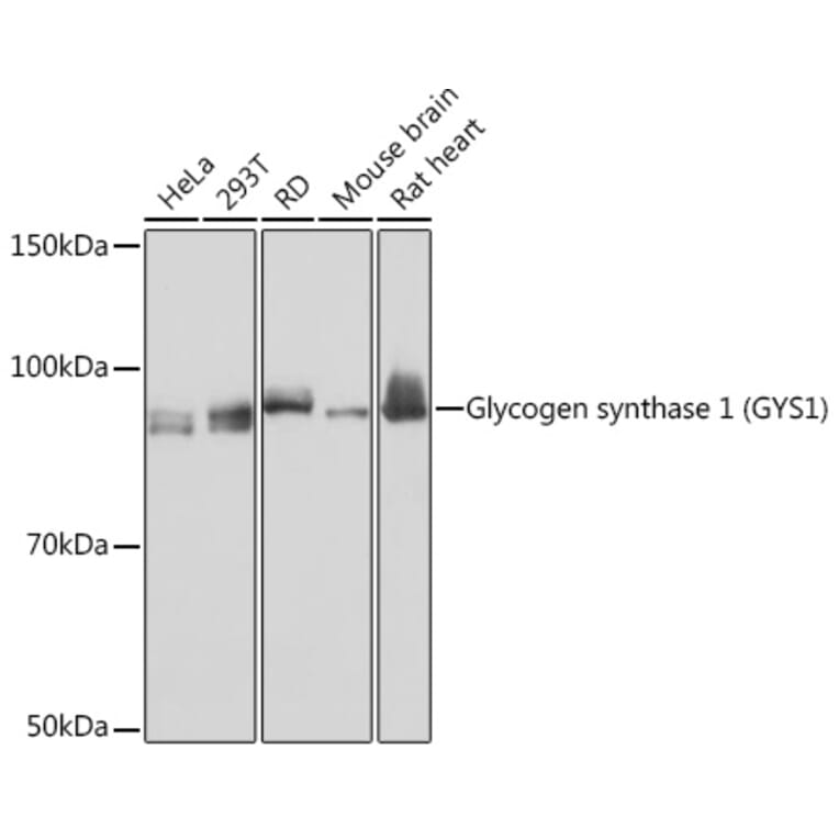 Western Blot - Anti-Glycogen synthase 1/GYS1 Antibody [ARC1350] (A308509) - Antibodies.com