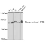 Western Blot - Anti-Glycogen synthase 1/GYS1 Antibody [ARC1350] (A308509) - Antibodies.com