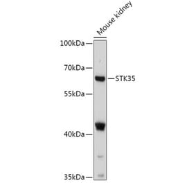 Western Blot - Anti-STK35 Antibody (A308510) - Antibodies.com
