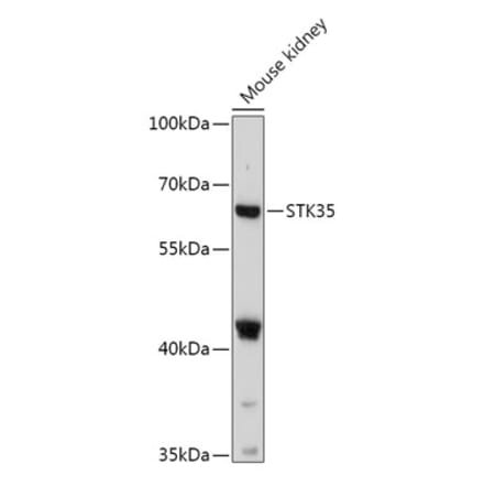 Western Blot - Anti-STK35 Antibody (A308510) - Antibodies.com