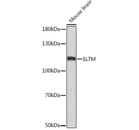 Western Blot - Anti-SLTM Antibody (A308511) - Antibodies.com
