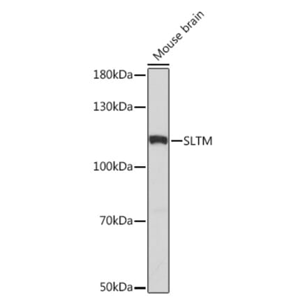 Western Blot - Anti-SLTM Antibody (A308511) - Antibodies.com