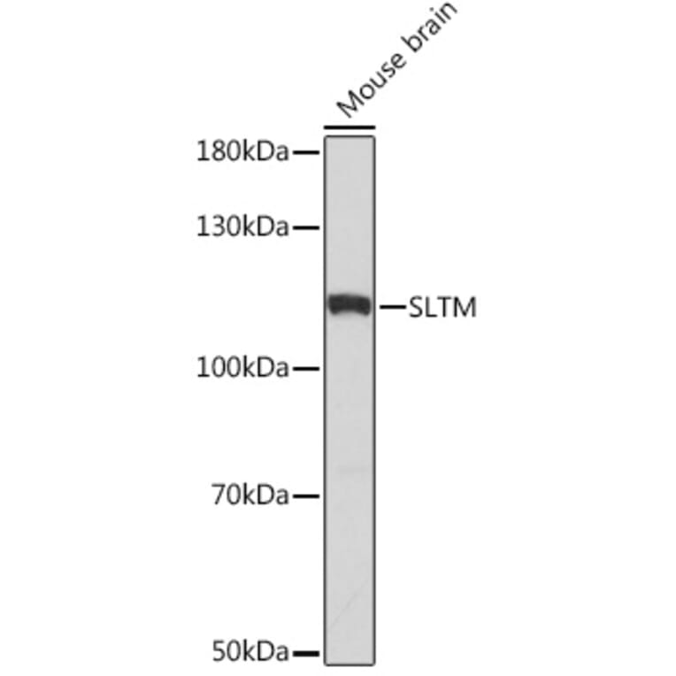 Western Blot - Anti-SLTM Antibody (A308511) - Antibodies.com