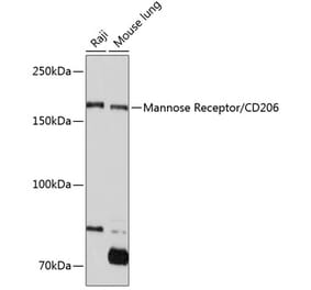 Western Blot - Anti-Mannose Receptor Antibody [ARC0538] (A308512) - Antibodies.com