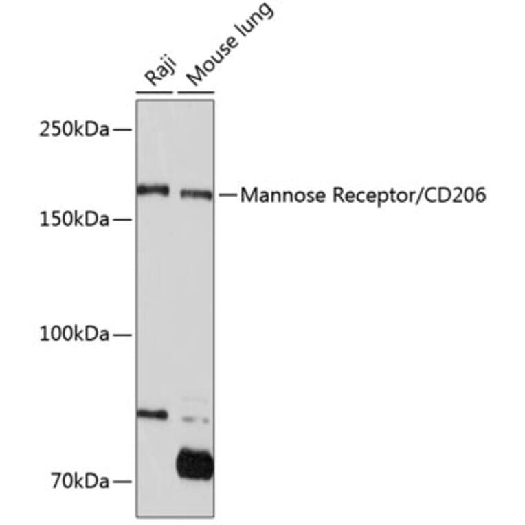 Western Blot - Anti-Mannose Receptor Antibody [ARC0538] (A308512) - Antibodies.com