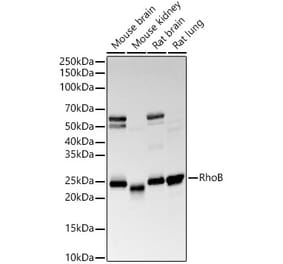 Western Blot - Anti-RhoB Antibody [ARC56483] (A308513) - Antibodies.com